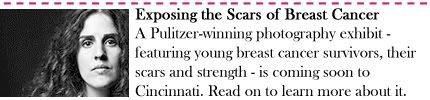 Exposing the Scars of Breast Cancer